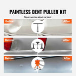 Amocart 107 PCS Dent Removal Kit, Paintless Dent Repair Kit Suction Cup Dent Puller for Auto Body Dents, Hail Damage, Door Ding